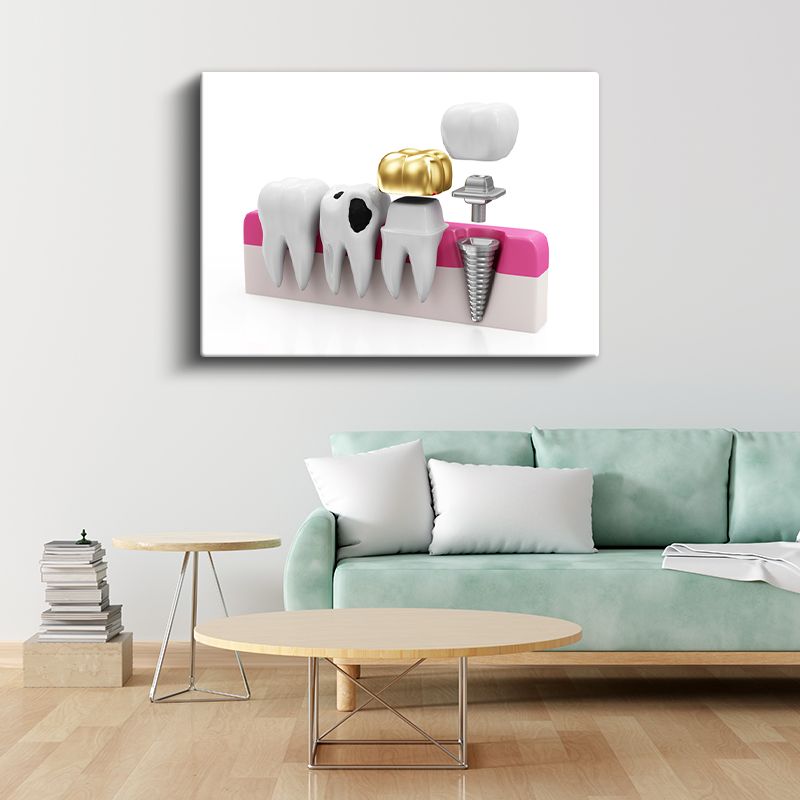 Diş Hekimi - İmplant ve Protez Teknolojisi Kanvas Tablo