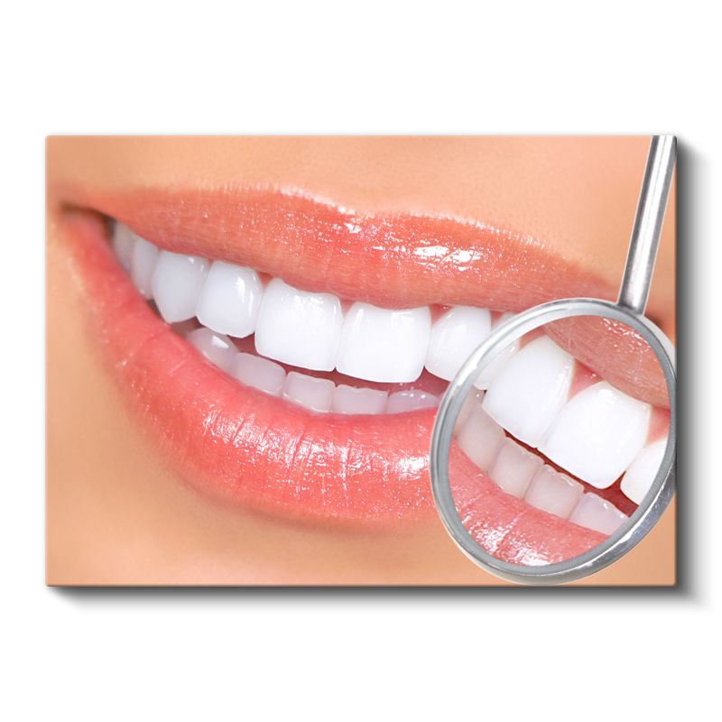 Diş Hekimi - Mükemmel Gülüş Kontrolü Kanvas Tablo