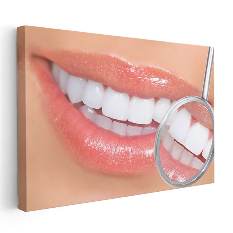 Diş Hekimi - Mükemmel Gülüş Kontrolü Kanvas Tablo