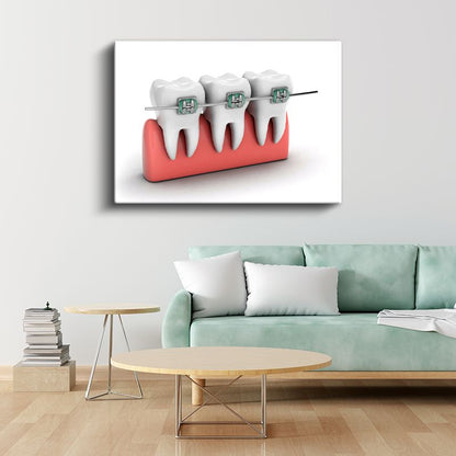 Ortodontist - Çağdaş Diş Teli Sistemleri ve Tedavi Yöntemleri Kanvas Tablo