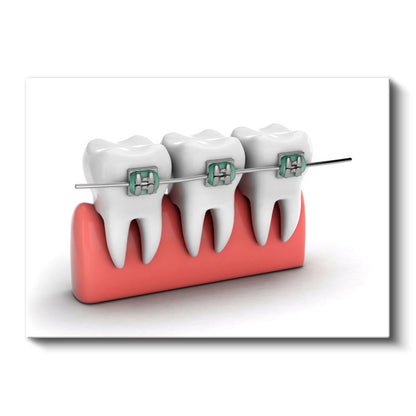 Ortodontist - Çağdaş Diş Teli Sistemleri ve Tedavi Yöntemleri Kanvas Tablo