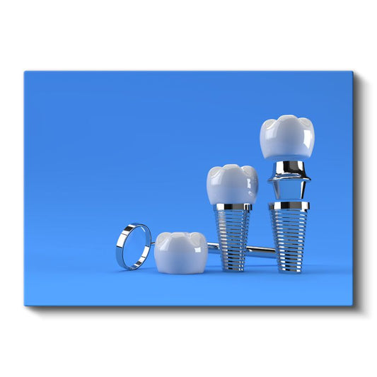 Diş Hekimi - Modern İmplant Cerrahisi ve Rehabilitasyon Kanvas Tablo