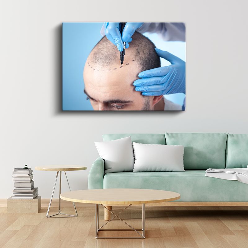 Estetik Cerrah - Saç Ekimi Operasyonu Kanvas Tablo