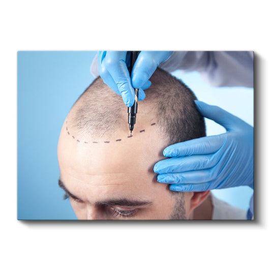 Estetik Cerrah - Saç Ekimi Operasyonu Kanvas Tablo