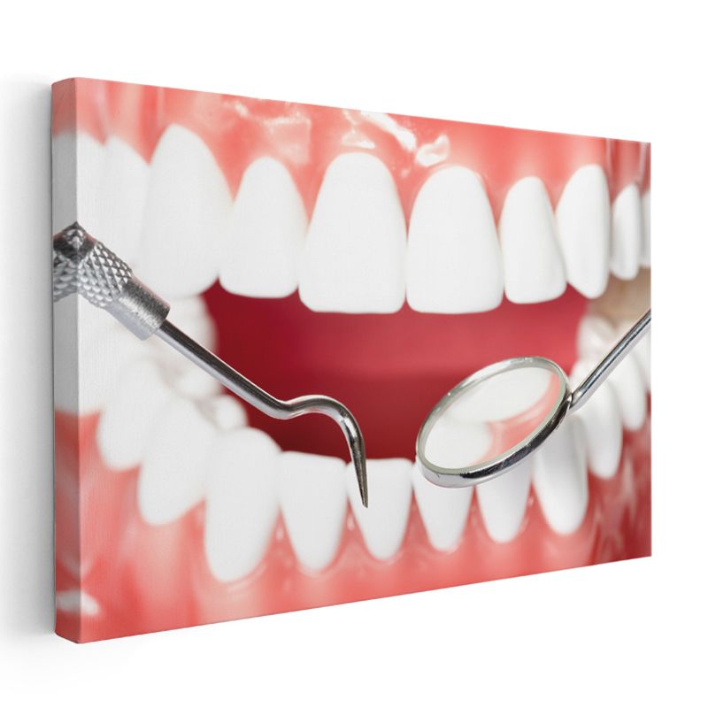 Diş Hekimi - Dental Muayene Aletleri Kanvas Tablo