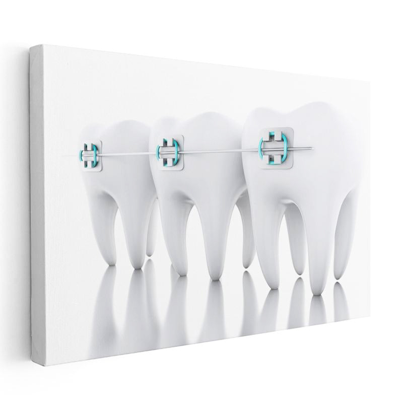 Yatay Kanvas Tablo Sıralı Diş Modeli Ve Teller Diş Hekimi Tablosu Ev Ofis Duvar Dekoru