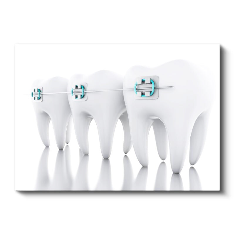 Yatay Kanvas Tablo Sıralı Diş Modeli Ve Teller Diş Hekimi Tablosu Ev Ofis Duvar Dekoru