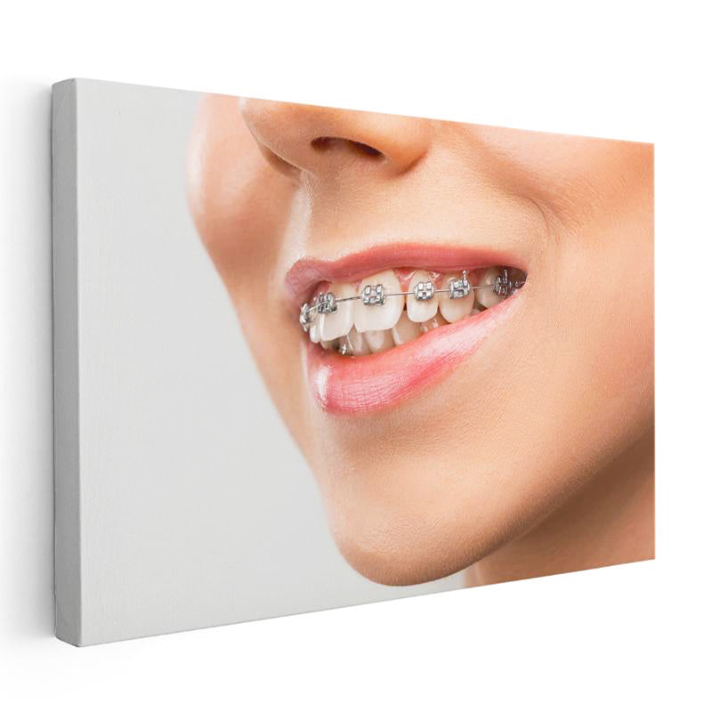 Yatay Kanvas Tablo Metal Diş Teli Ve Dudak Detayı Diş Hekimi Tablosu Ev Ofis Duvar Dekoru
