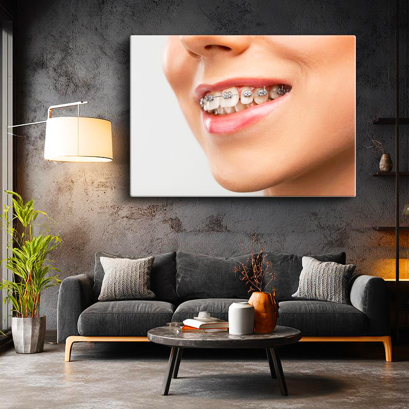 Yatay Kanvas Tablo Metal Diş Teli Ve Dudak Detayı Diş Hekimi Tablosu Ev Ofis Duvar Dekoru