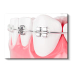 Yatay Kanvas Tablo Diş Üzerinde Ortodontik Braketler Diş Hekimi Tablosu Ev Ofis Duvar Dekoru
