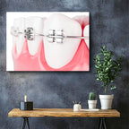 Yatay Kanvas Tablo Diş Üzerinde Ortodontik Braketler Diş Hekimi Tablosu Ev Ofis Duvar Dekoru