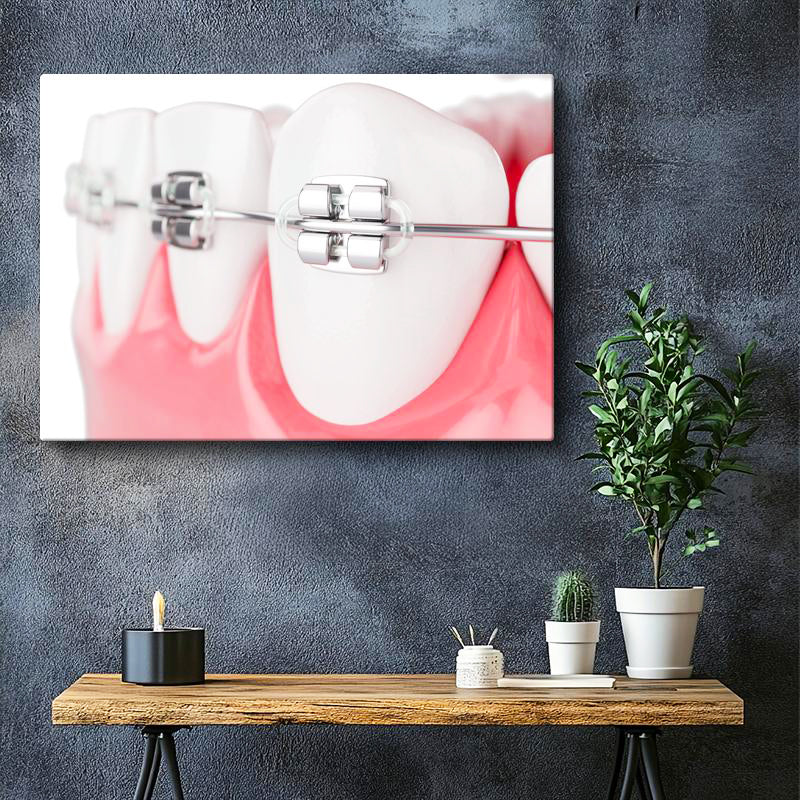 Yatay Kanvas Tablo Diş Üzerinde Ortodontik Braketler Diş Hekimi Tablosu Ev Ofis Duvar Dekoru