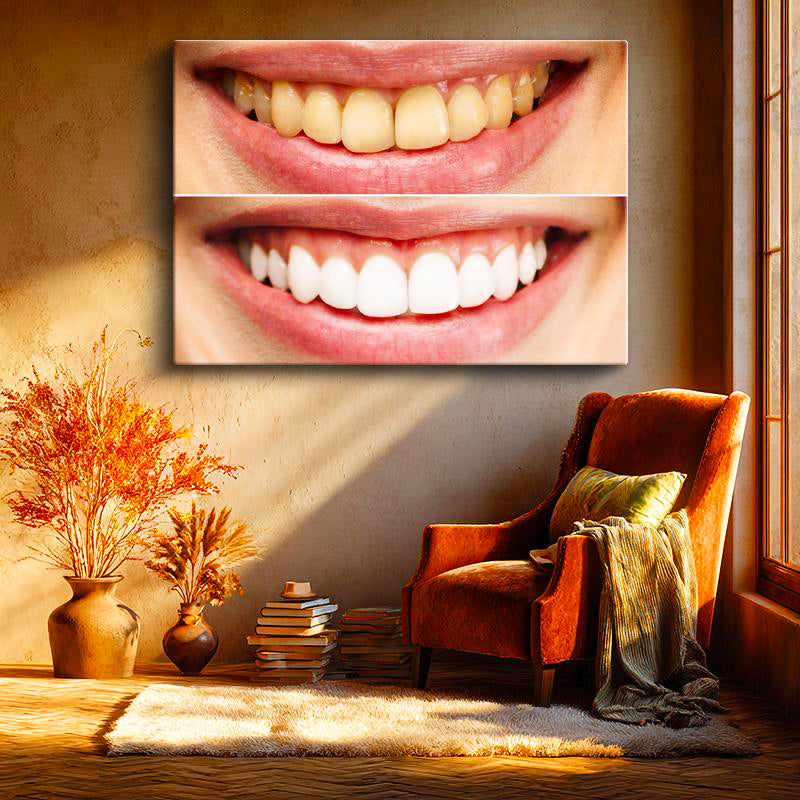 Yatay Kanvas Tablo Diş Beyazlatma İşlemi Öncesi Sonrası Diş Hekimi Tablosu Ev Ofis Duvar Dekoru